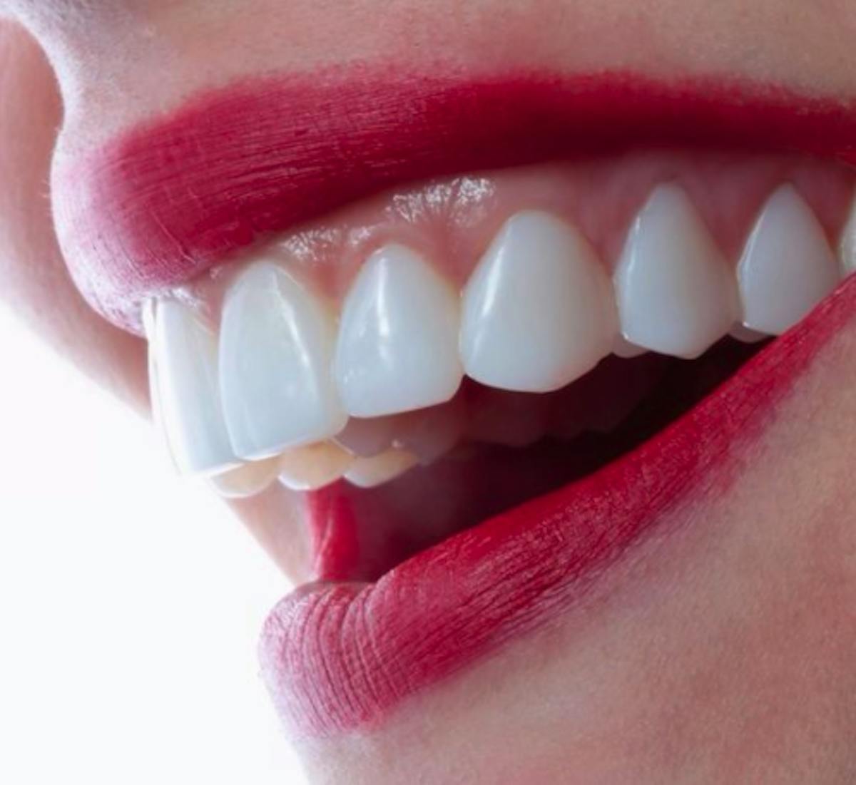 Orthodontic Solutions